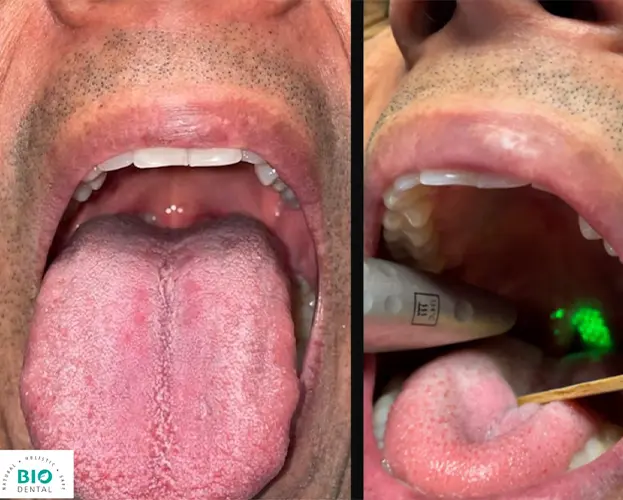 Dentist holding laser